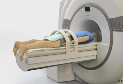 MRI Prostaatbiopsie